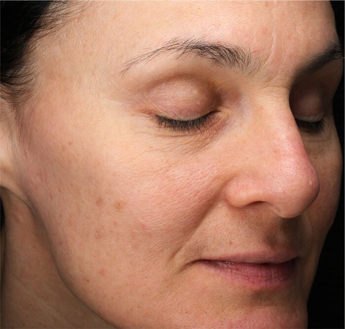 Extra Rich Cleansing Foam, 