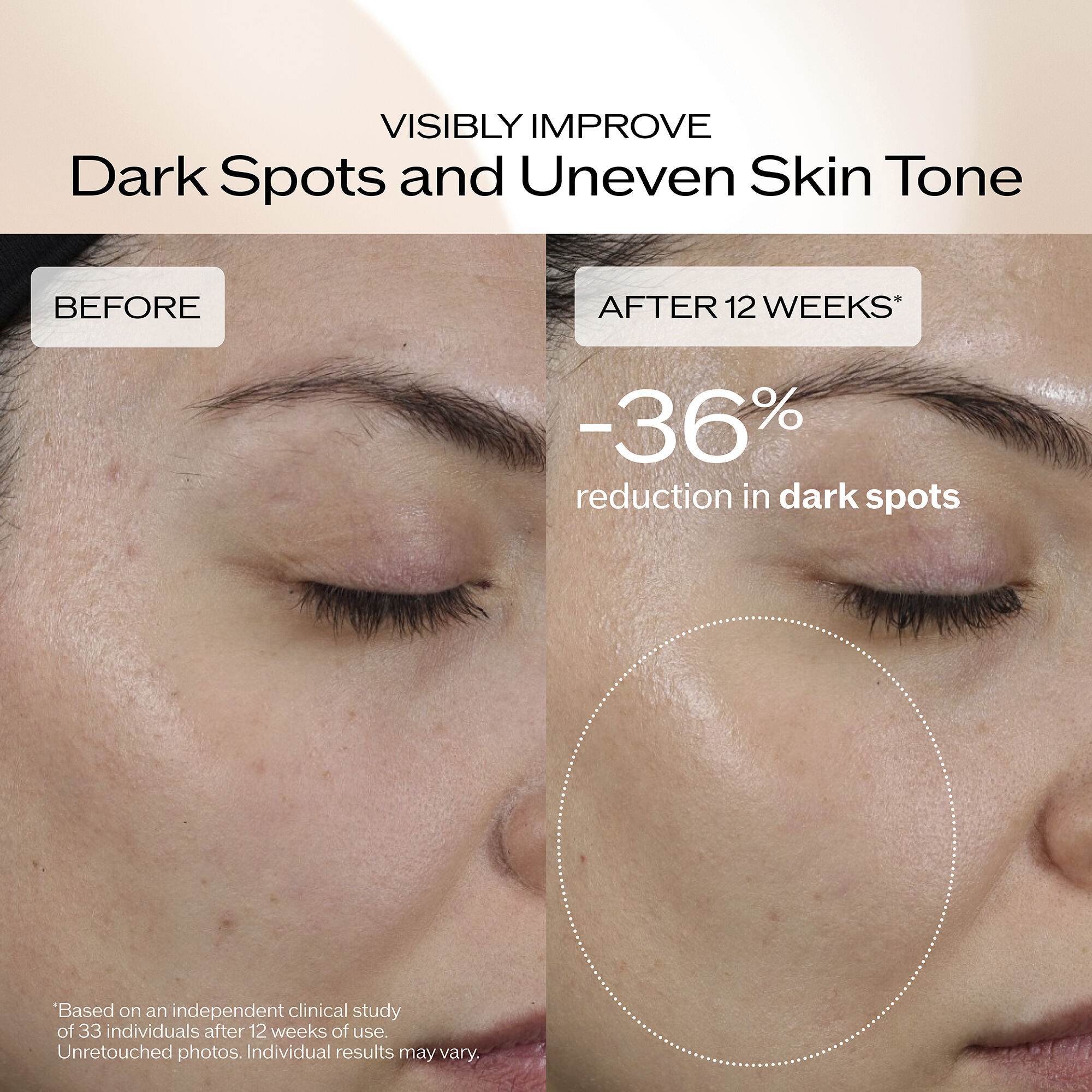 Dark Spot and Wrinkle Smoothing Serum, 