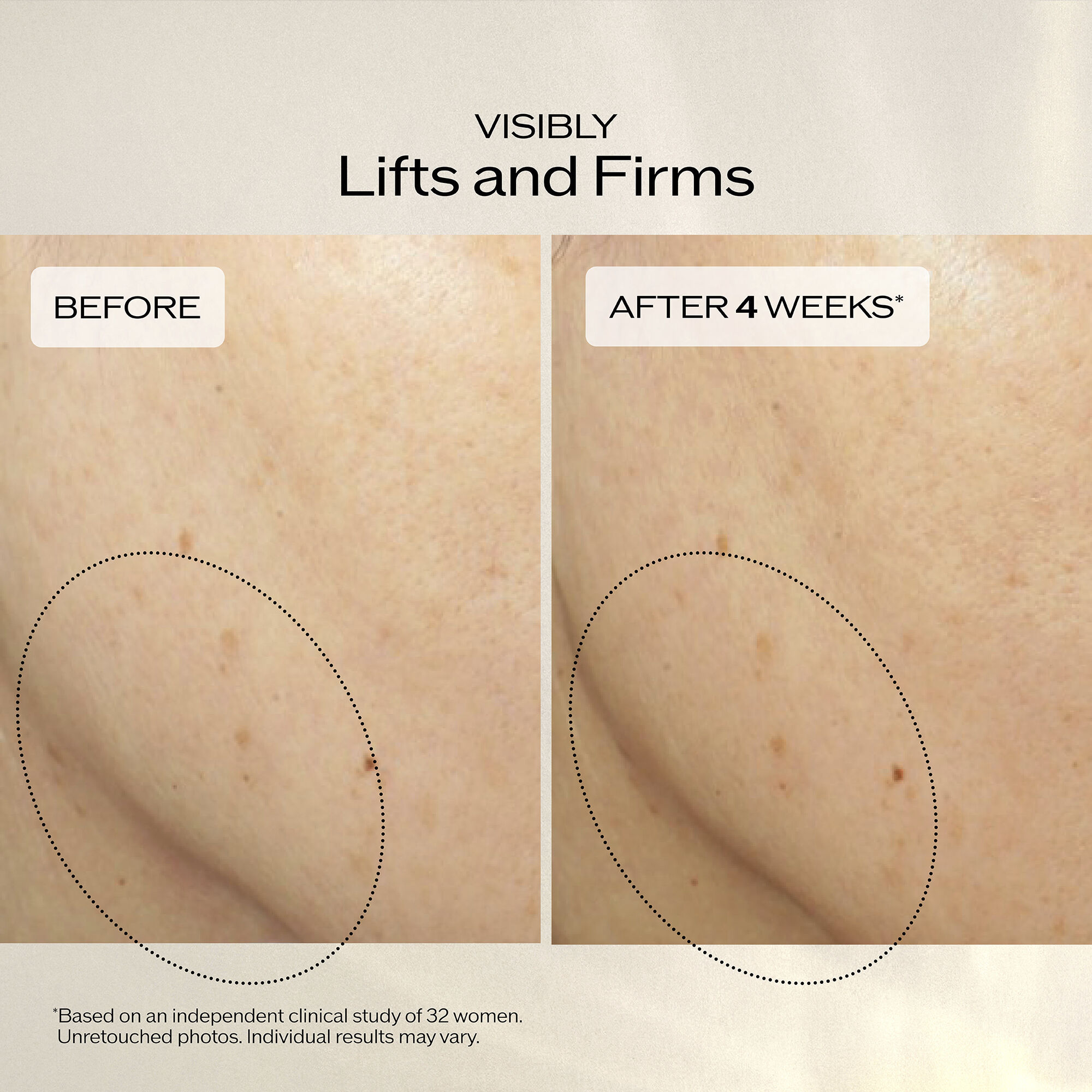 Uplifting and Firming Advanced Cream, 