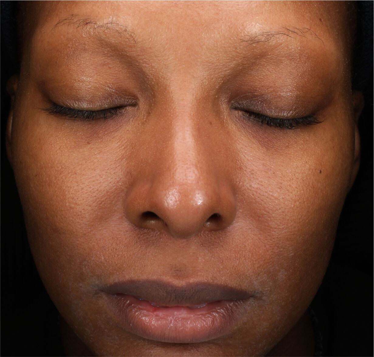 Total Regenerating Cream,