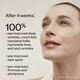 Intensive WrinkleSpot Treatment A+,