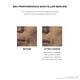 Skin Filler Serums,
