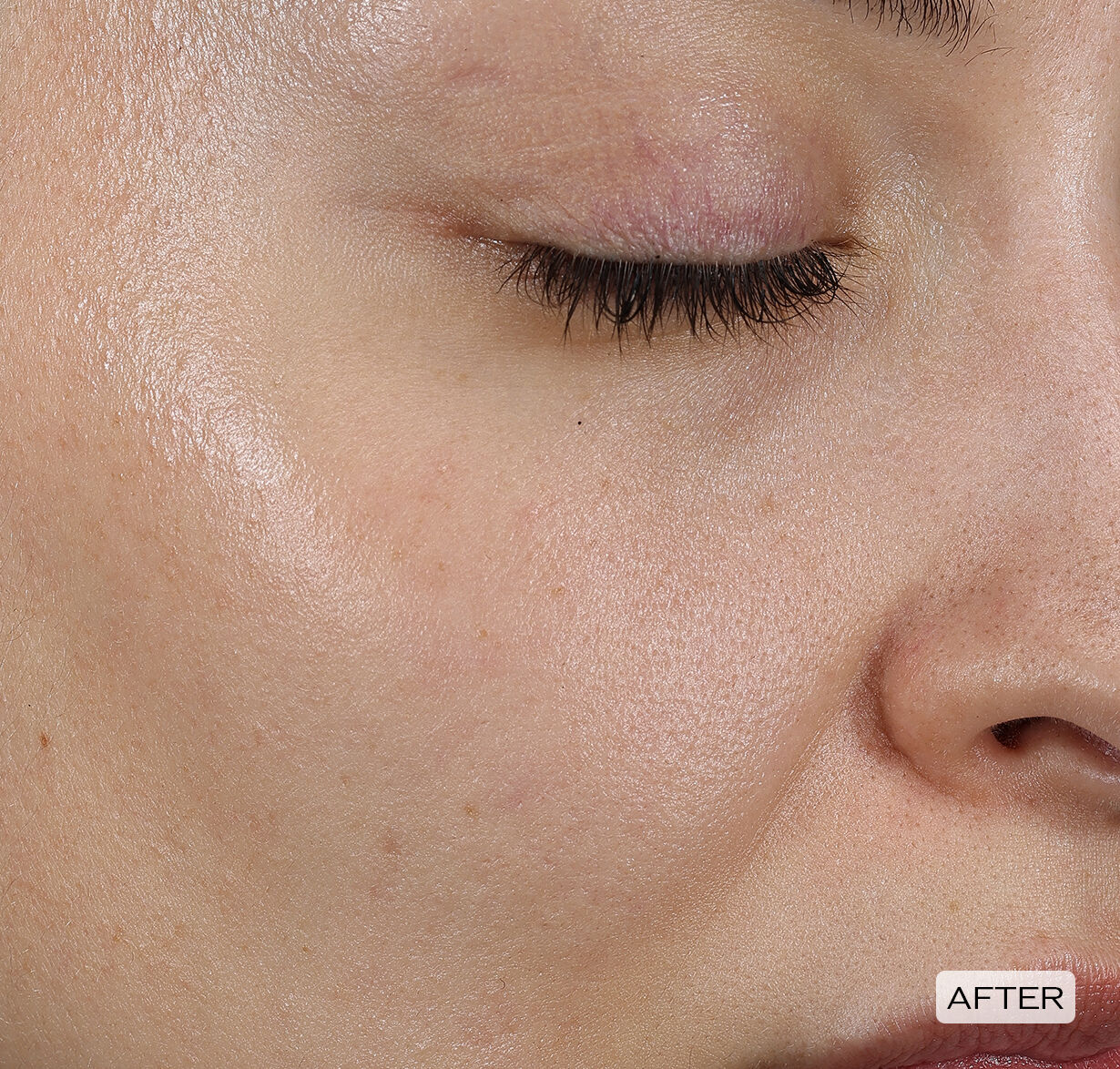 Dark Spot and Wrinkle Smoothing Serum, 