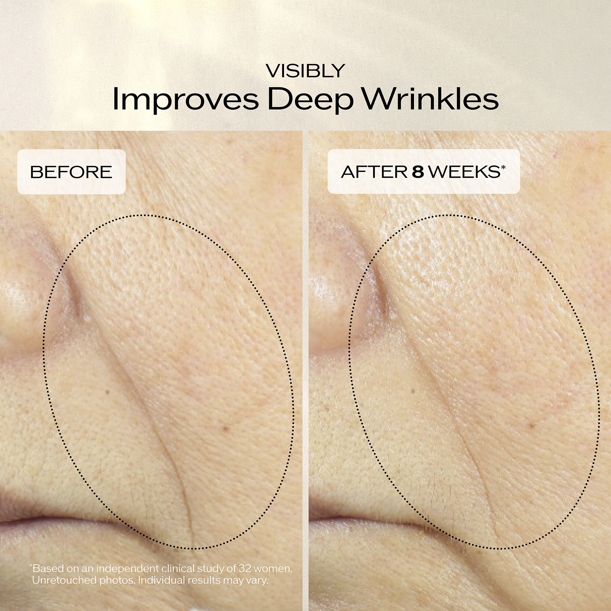 Uplifting and Firming Advanced Cream, 