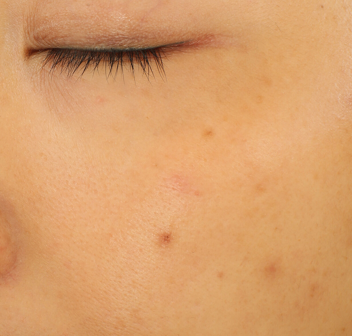 Ultimune Power Infusing Serum & Refill Bundle ($296 Value), 