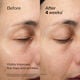 Eye and Lip Contour Regenerating Cream,