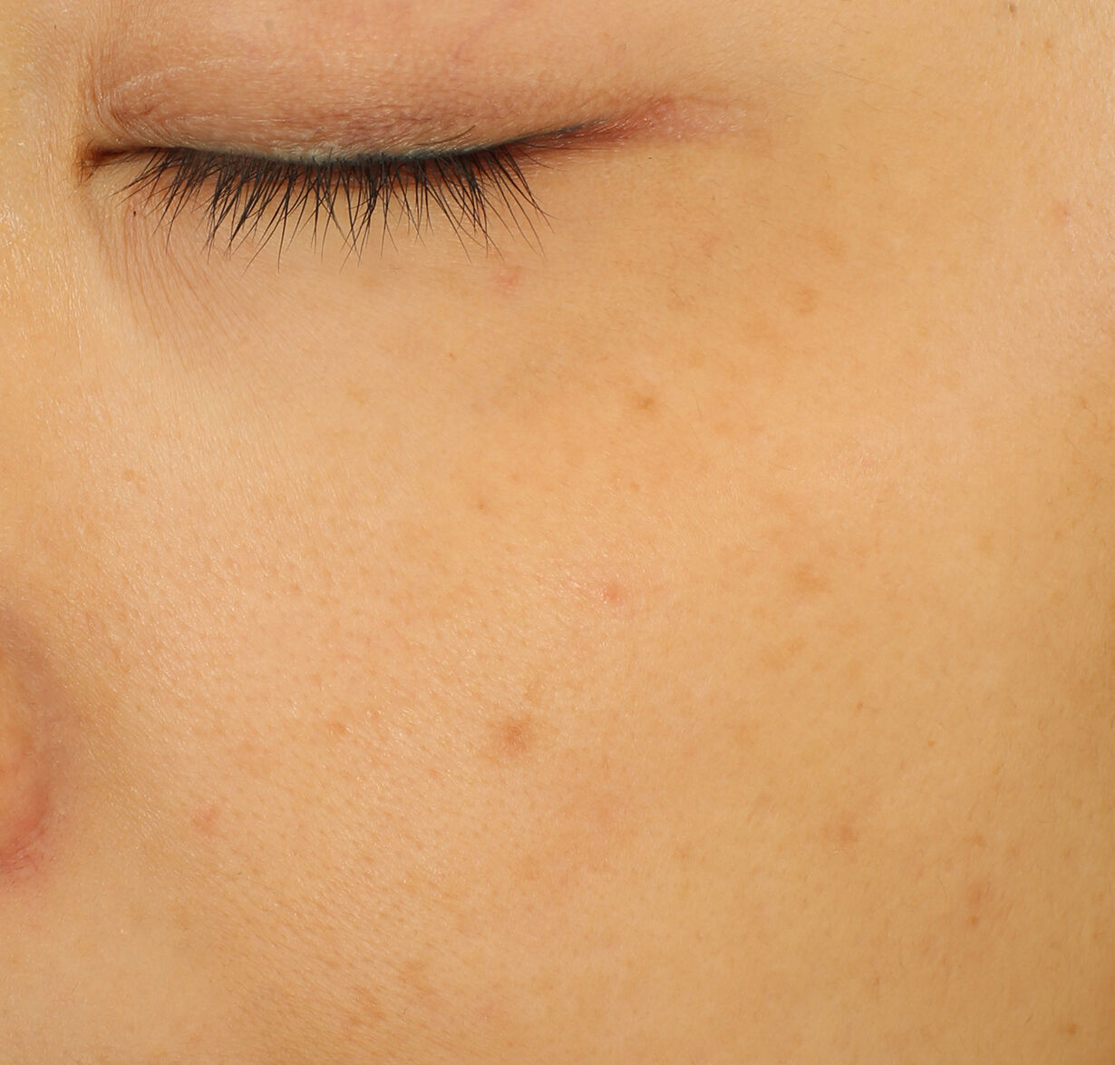 Ultimune Power Infusing Serum & Refill Bundle ($296 Value), 