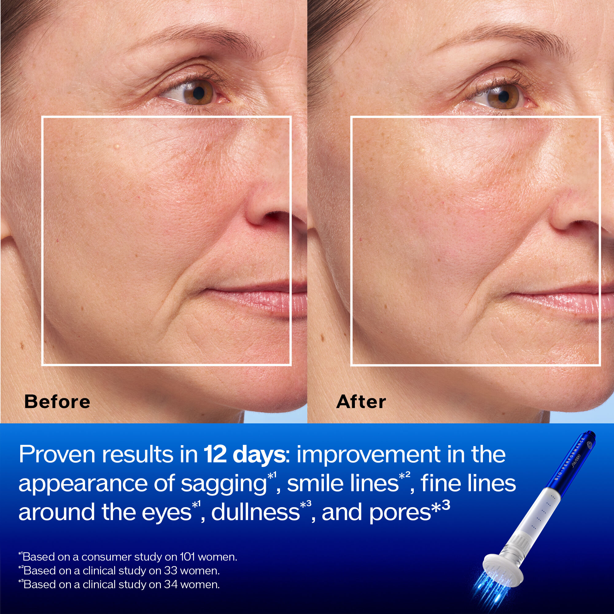 Bio-Performance Micro-Click Concentrate | SHISEIDO