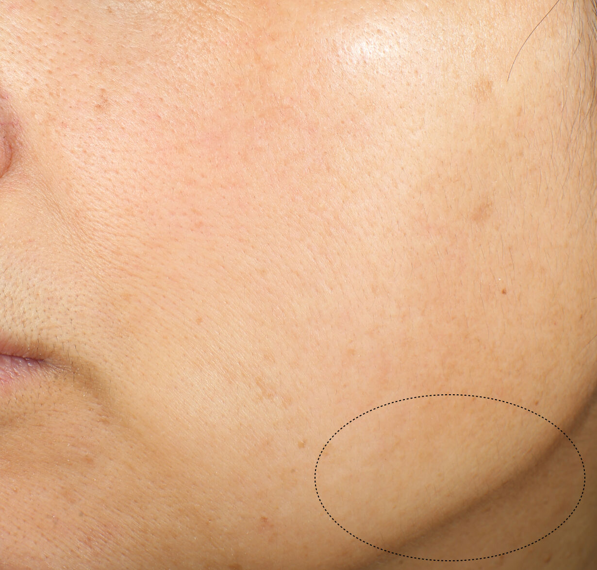 Uplifting and Firming Advanced Cream, 