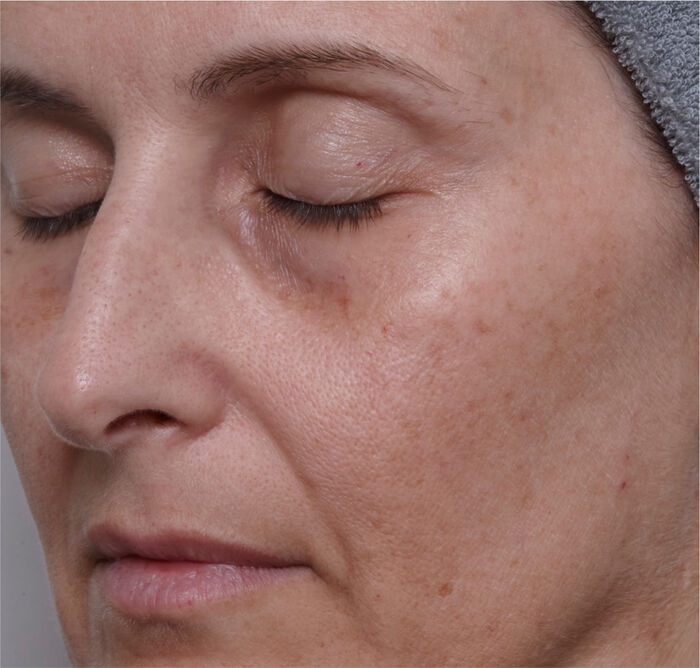 Intensive Firming Brilliance Serum,