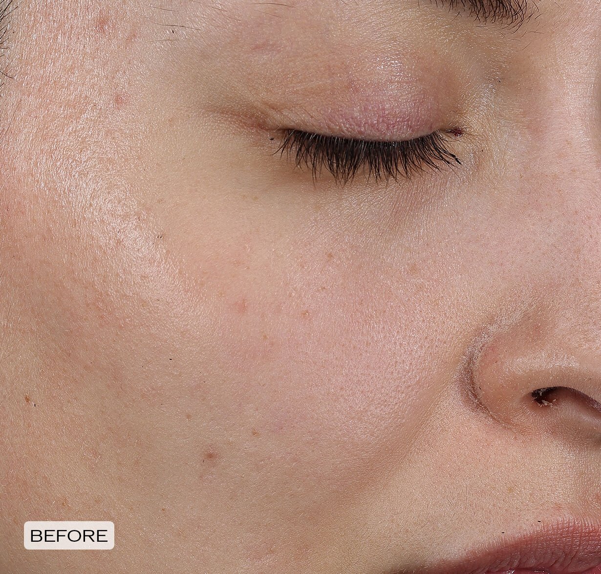 Dark Spot and Wrinkle Smoothing Serum, 