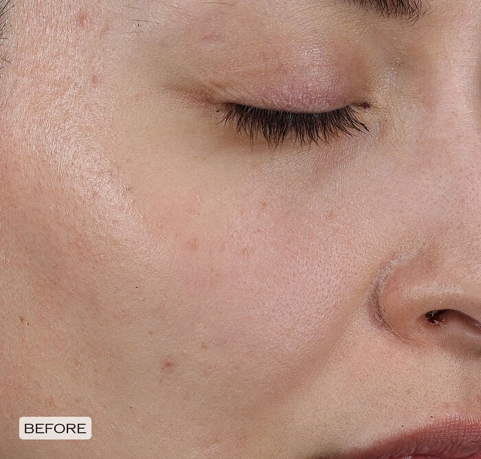 Dark Spot and Wrinkle Smoothing Serum, 