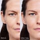 Skin Filler Serums,